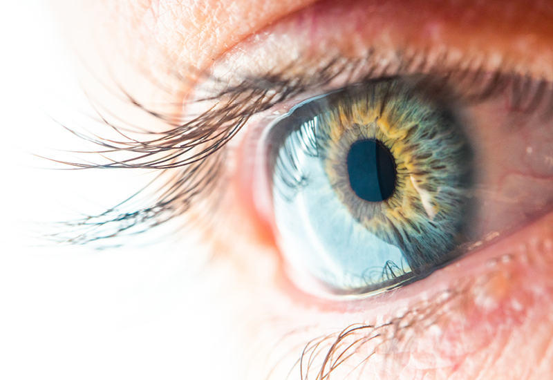 Irisdiagnose Augendiagnose
